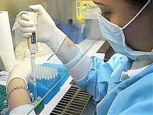 l'aquila, record, meningite, batterio, provetta